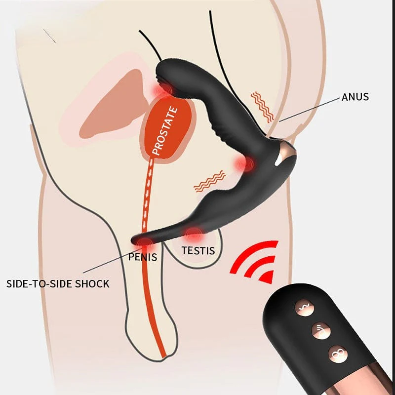 Anal Plug Pull Prostate Massager Wireless Remote Control Double Shock Sex Masturbator Adult Products - Image 4